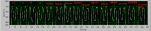 Beamblock-individual_electrodes.PNG