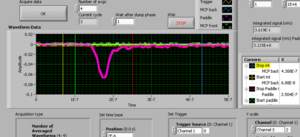 paddle_5point25MHz30ms_1.PNG